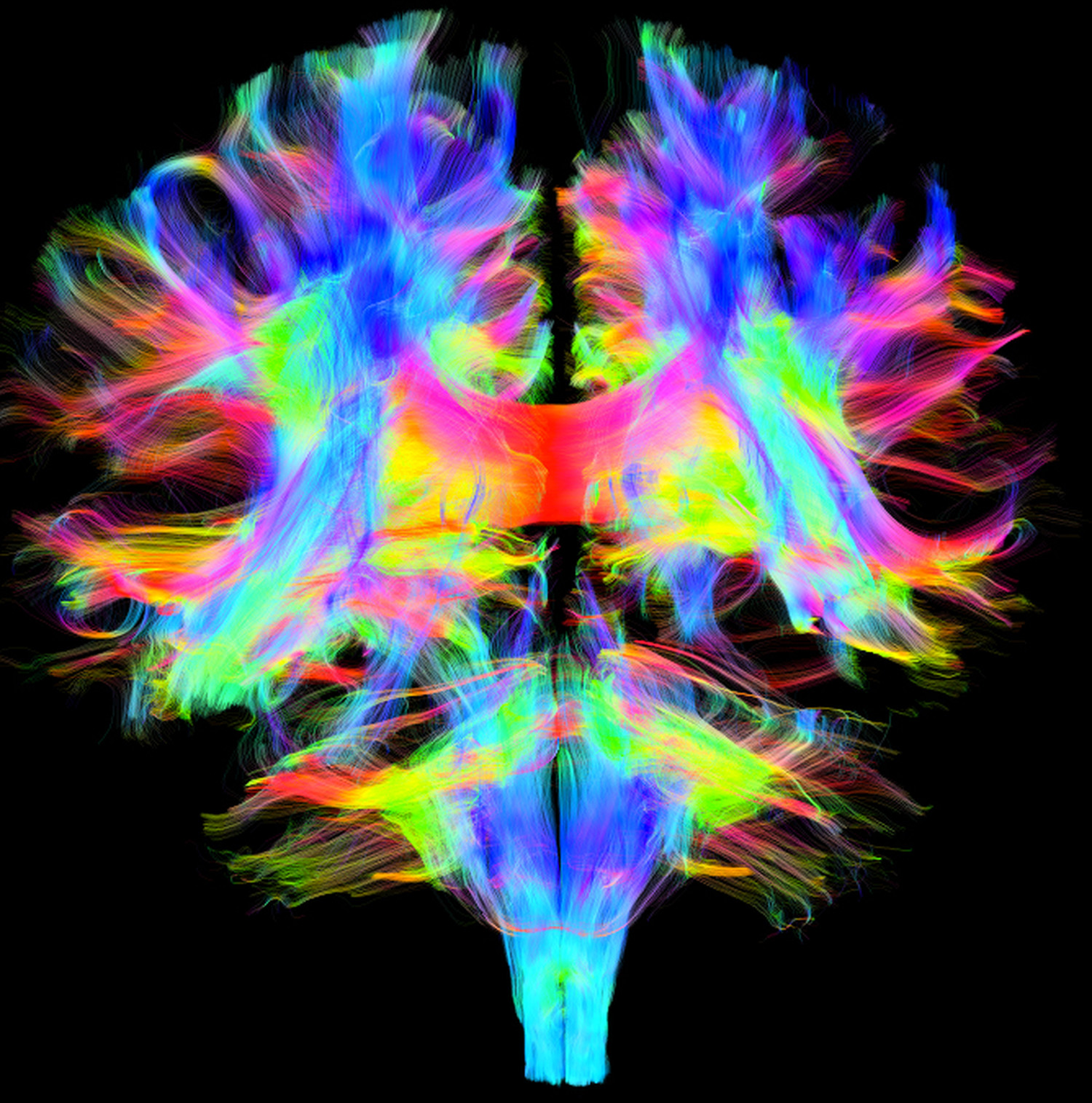 Mighty MRI • Discovery