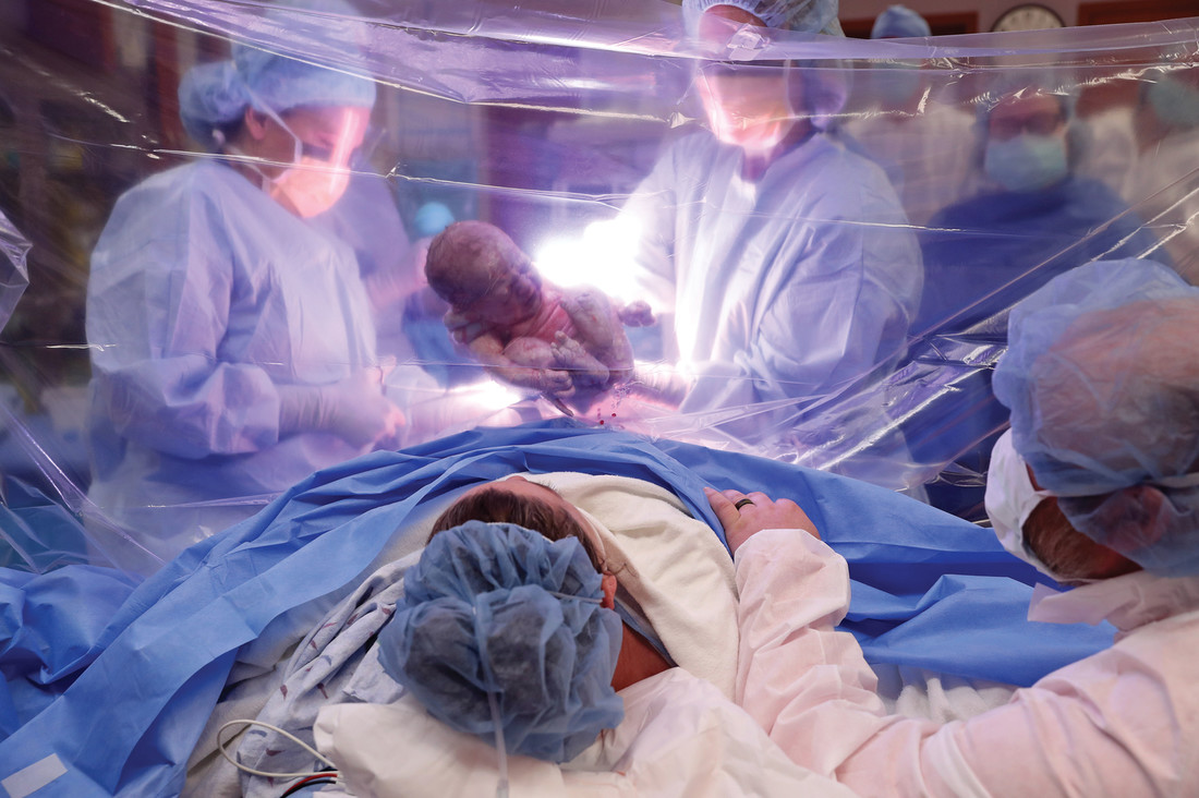 gentle cesarean sentara martha jefferson magazine gentle cesarean birth plan